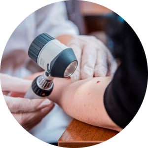 Дерматоскопія